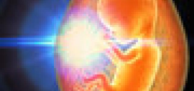 Evolution Update 1_sm
